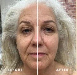 KENZORA™ Lymphatic Face Brush